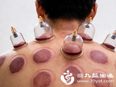 新手拔罐不知控时？牢记“这个区间”最安全！