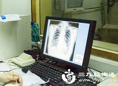 X线检查更适合用于初步筛查和常规体检,尤其适用于骨骼系统、胸部、胃肠道等部位的基础检查 X线检查更适合用于初步筛查和常规体检,尤其适用于骨骼系统、胸部、胃肠道等部位的基础检查