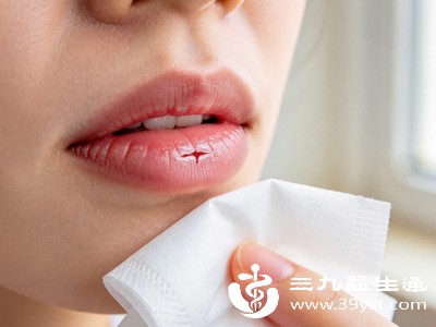 嘴角反复开裂、发白、糜烂,可能与细菌或真菌感染有关 嘴角反复开裂、发白、糜烂,可能与细菌或真菌感染有关