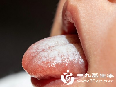 小月龄宝宝唾液分泌少,口腔自洁能力弱,母乳或配方奶中的蛋白质、脂肪容易附着在舌面上,形成一层薄薄的白色奶苔 小月龄宝宝唾液分泌少,口腔自洁能力弱,母乳或配方奶中的蛋白质、脂肪容易附着在舌面上,形成一层薄薄的白色奶苔