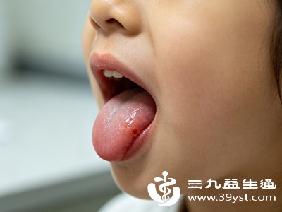 低温环境是导致宝宝舌头发紫的常见生理性原因 低温环境是导致宝宝舌头发紫的常见生理性原因