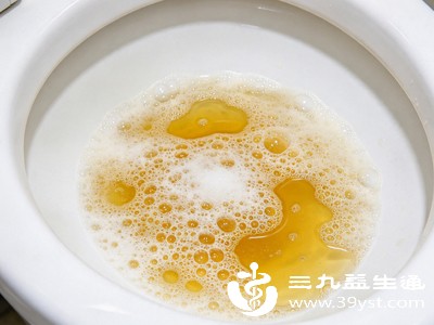 中医认为小便短黄多与“热”和“湿”有关,常见于心火偏旺、肝胆湿热、膀胱湿热、胃肠实热、阴虚内热等 中医认为小便短黄多与“热”和“湿”有关,常见于心火偏旺、肝胆湿热、膀胱湿热、胃肠实热、阴虚内热等