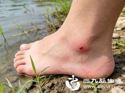 前往水田劳作或户外徒步时，尽量穿长袖上衣、长裤，裤脚可扎紧或塞进袜子里，避免皮肤直接暴露