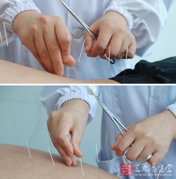 针刺和膏药敷贴治疗颞下颌关节紊乱病