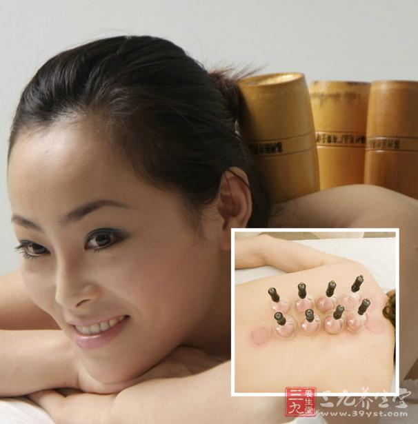 中医拔罐 拔罐的好处有哪些