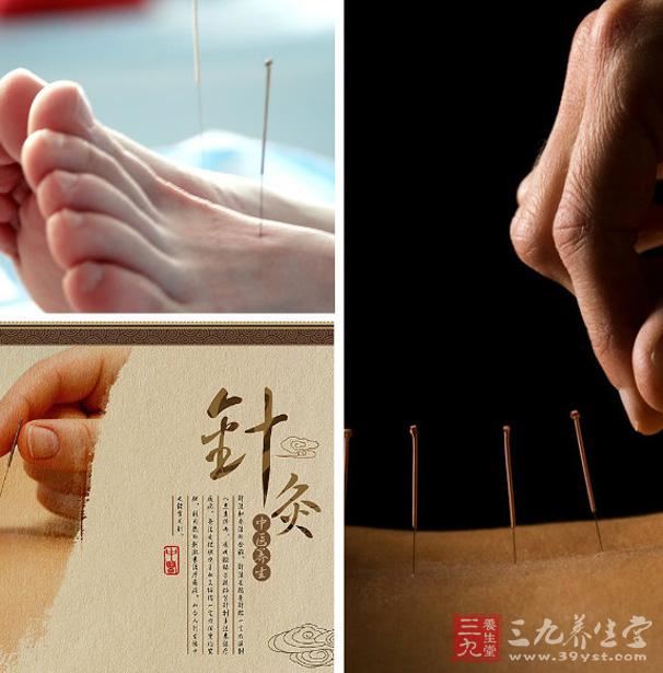 针灸补和泻是什么原理_针灸补泻手法图解