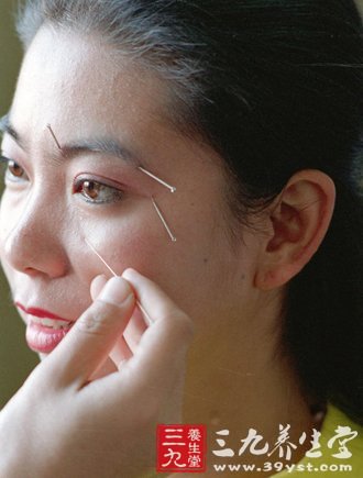 铍针 解决你的皮神经问题(6)