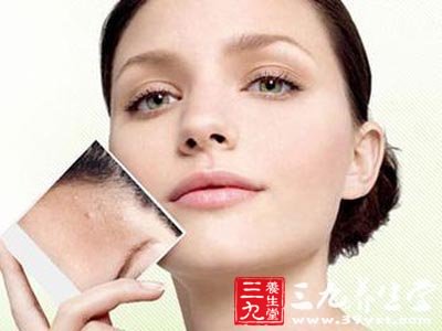 如何正确涂抹凡士林 134013K94-5.jpg