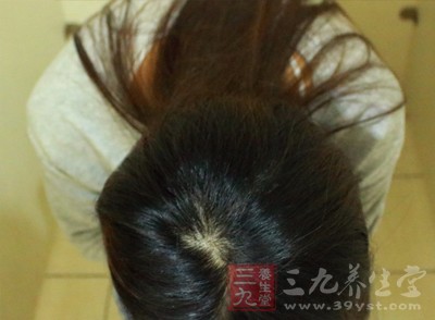 什么时候要做膀胱镜检查 20170116034239939.jpg