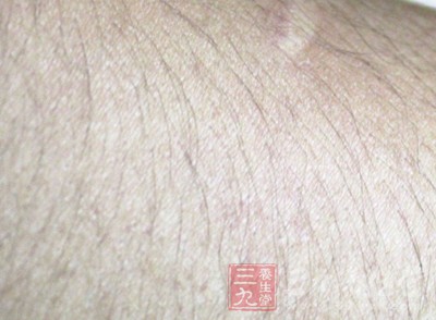 20170122032404605.jpg